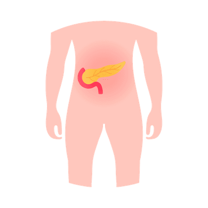 Pancreatitis