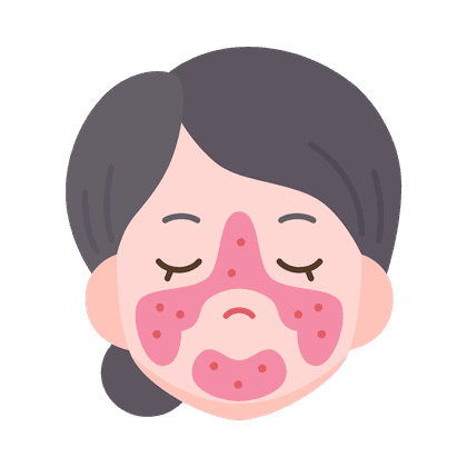 Couperose