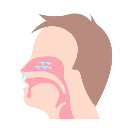 Sinusitis, sinusitis, frontitis