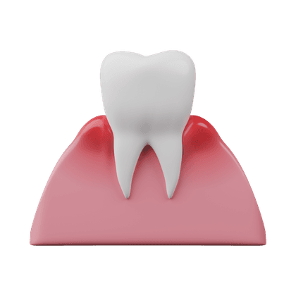 Periodontal disease and periodontitis